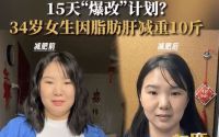 34岁南京女生脂肪肝15天减重10斤，合理饮食成关键